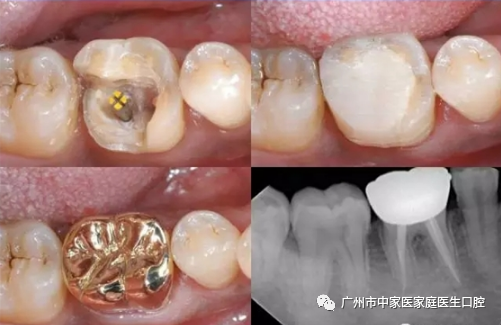 牙医也疯狂游戏手机版下载_疯狂牙医怎么玩_牙医也疯狂游戏