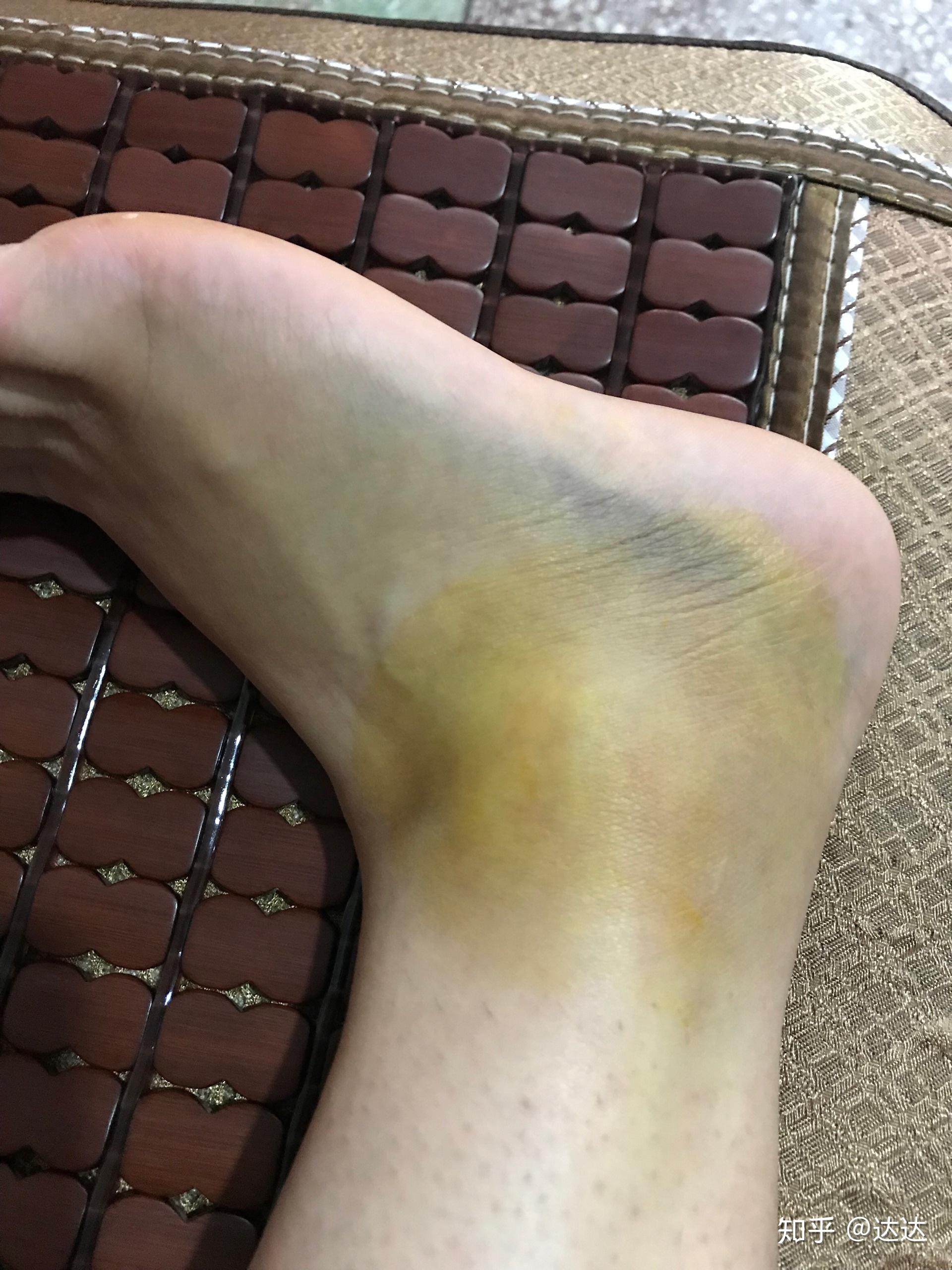 玩手机游戏受伤视频女_玩手机受伤的视频_玩游戏摔手机的视频