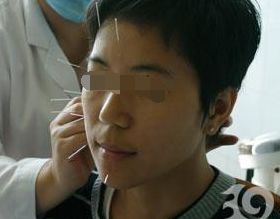 治面瘫的游戏,趣味游戏助力轻松恢复(图1) 治面瘫的游戏,趣味游戏助力轻松恢复(图1)