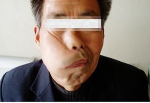治面瘫的游戏,趣味游戏助力轻松恢复(图3) 治面瘫的游戏,趣味游戏助力轻松恢复(图3)