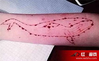 蓝色鲸鱼死亡游戏,一场网络恐怖的死亡挑战(图2) 蓝色鲸鱼死亡游戏,一场网络恐怖的死亡挑战(图2)