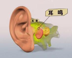 耳鸣游戏,沉浸式游戏体验带你领略听觉世界的奇妙之旅(图2) 耳鸣游戏,沉浸式游戏体验带你领略听觉世界的奇妙之旅(图2)