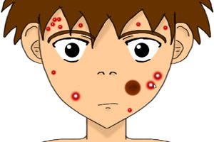 痘痘的游戏,痘痘的奇幻冒险之旅(图1) 痘痘的游戏,痘痘的奇幻冒险之旅(图1)