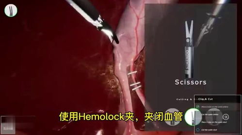 胆囊游戏,探索神秘胆囊世界的奇幻冒险之旅(图3) 胆囊游戏,探索神秘胆囊世界的奇幻冒险之旅(图3)