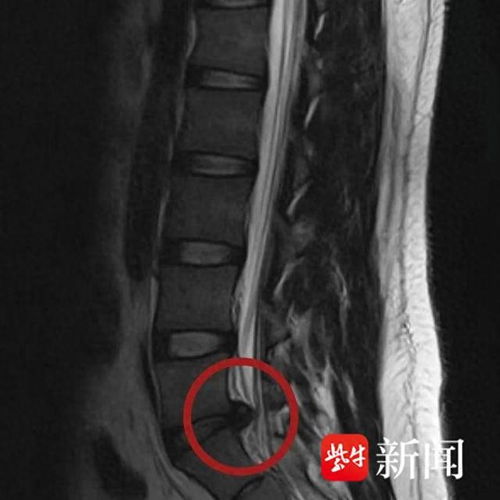 久坐游戏腰椎,揭秘久坐与腰椎疼痛的关联(图3) 久坐游戏腰椎,揭秘久坐与腰椎疼痛的关联(图3)