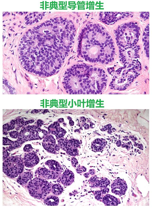 浮亏和浮盈_浮亏是亏吗_浮亏是什么意思