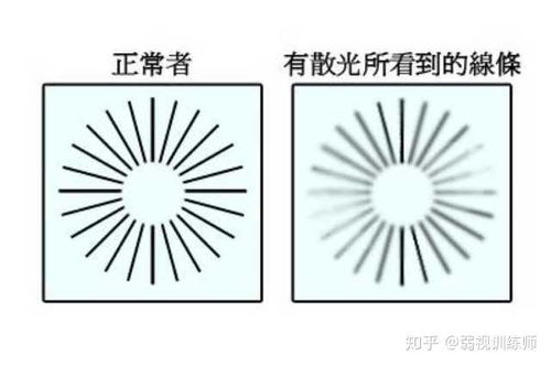 散光自测游戏,趣味散光自测游戏体验(图3) 散光自测游戏,趣味散光自测游戏体验(图3)