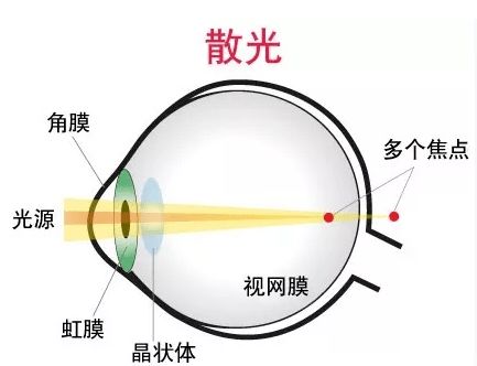 散光自测游戏,趣味散光自测游戏体验(图2) 散光自测游戏,趣味散光自测游戏体验(图2)