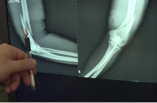 创伤手术游戏,游戏化教学新篇章(图3) 创伤手术游戏,游戏化教学新篇章(图3)