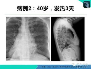 窦炎游戏,探索耳鼻喉健康新体验(图2) 窦炎游戏,探索耳鼻喉健康新体验(图2)